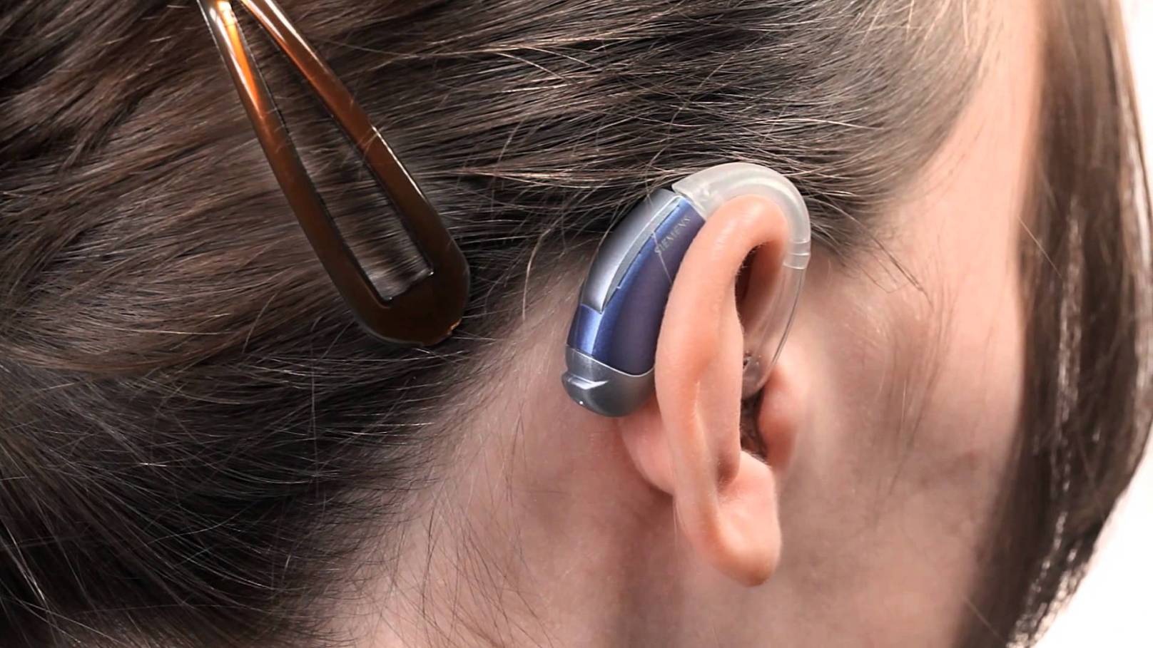 Ear hearing. Заушные слуховые аппараты (BTE). Слуховой аппарат Нео классика 675p. Слуховой аппарат цифровой заушный мощный. Audifon слуховые аппараты.